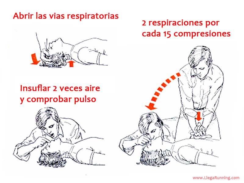 como actuar ante un infarto de miocardio como actuar ante un infarto de miocardio